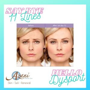 Botox & Dysport